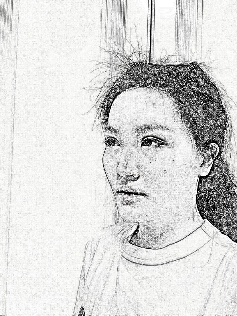 上海光博士门诊部医生李彬眼部手术介绍分享!