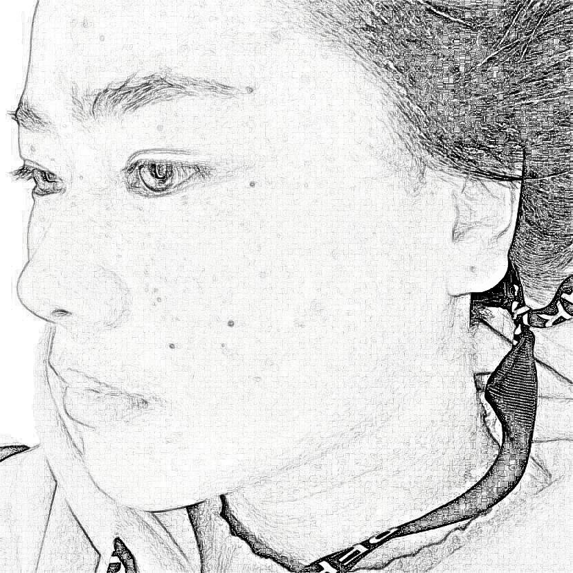 成都美诗沁医疗美容注射瘦脸介绍分享!