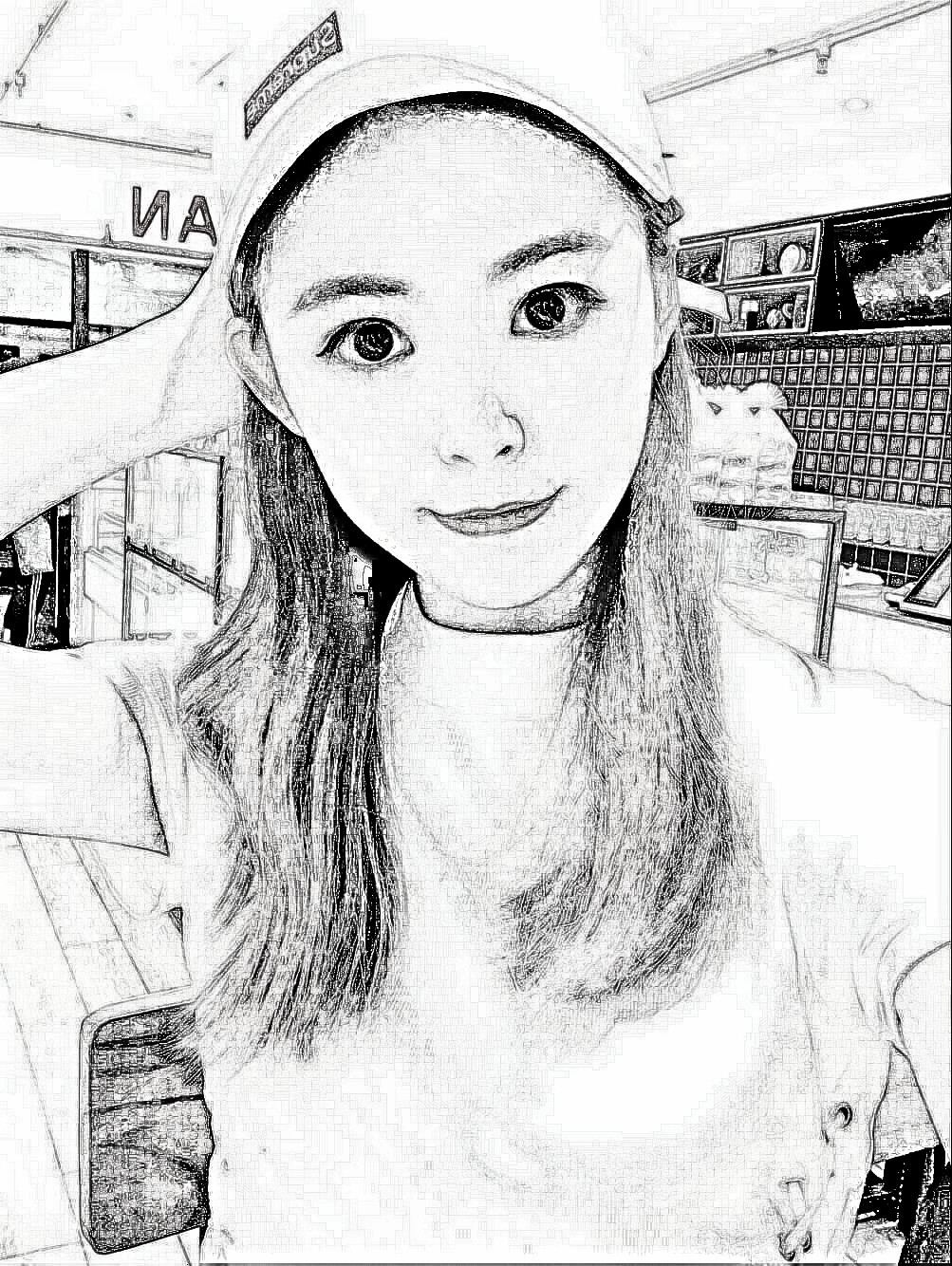 北京壹加壹医疗美容门诊部硅胶隆鼻果如何?