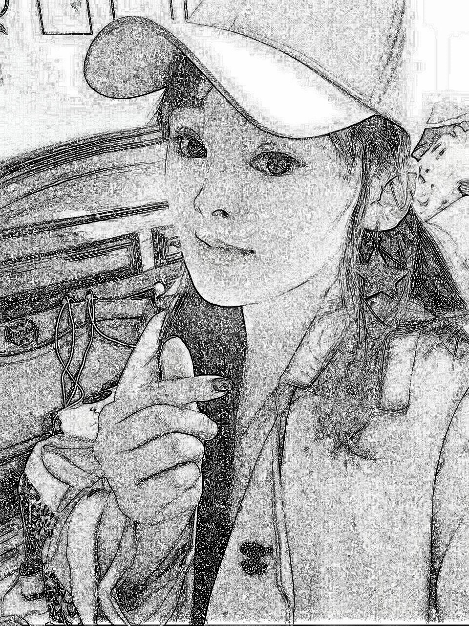 苏州爱美者埋线提升提升术后分享！