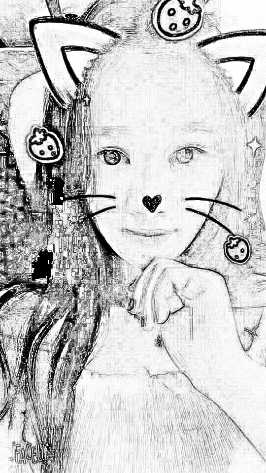 【双眼皮介绍】广东美恩整形切开双眼皮果
