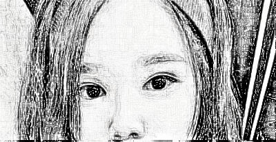 成都美极医疗美容自切开双眼皮介绍分享!