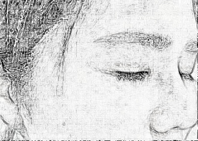 成都美极医疗美容自切开双眼皮介绍分享!