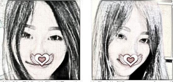 南宁华美医学美容医生刘真俊玻尿酸垫下巴介绍