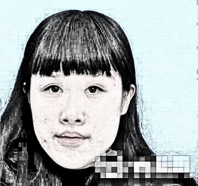 张家港康利专科医院整形科切开双眼皮介绍分享
