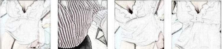 福州美贝尔医美医生张胜利乳房缩小介绍分享！