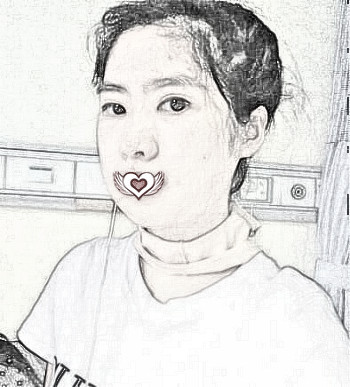 南宁婉美医美面部磨骨术后果分享!
