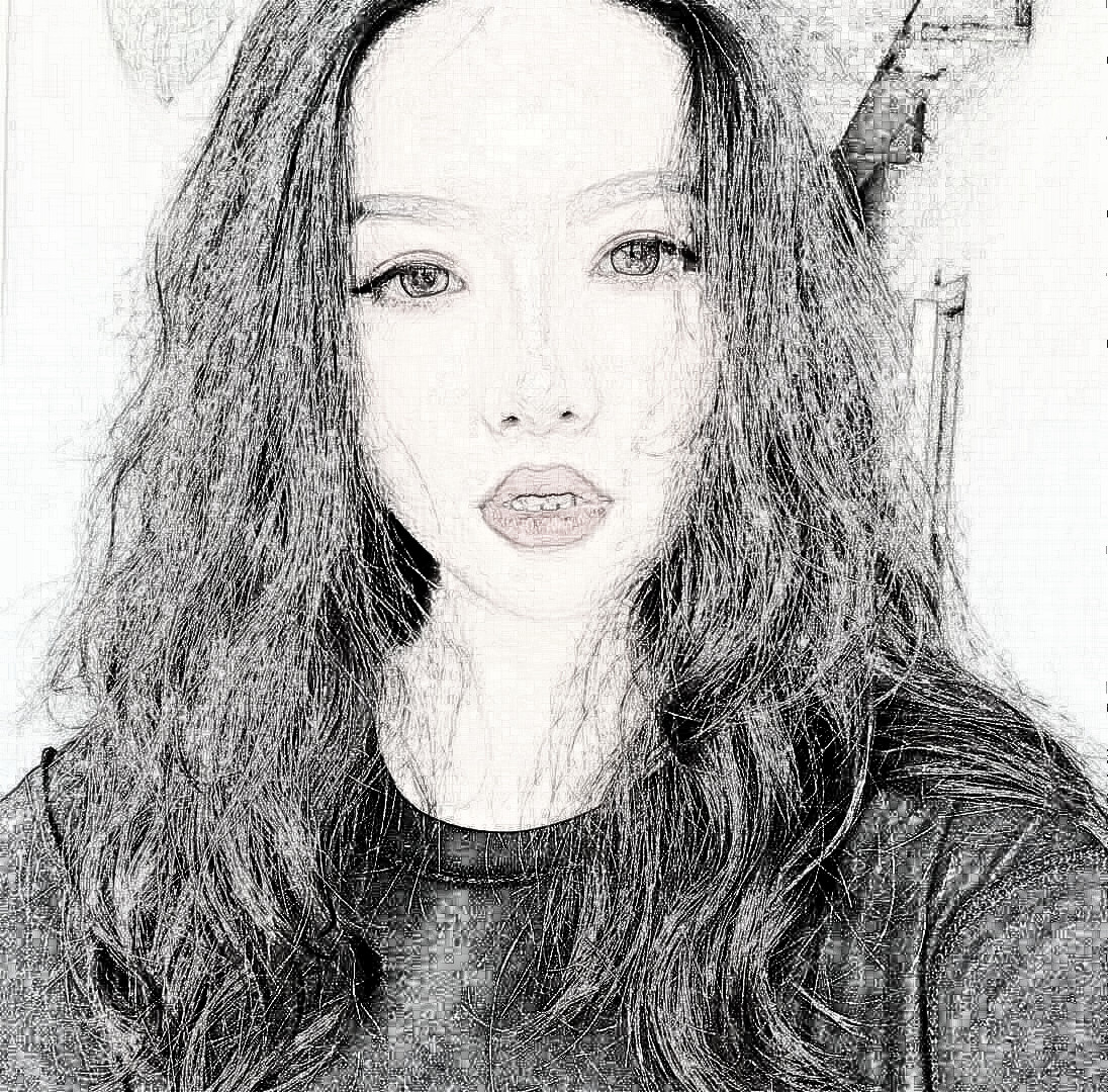 【膨体隆鼻】成都素美医疗美容卢元刚做的鼻子怎么样!