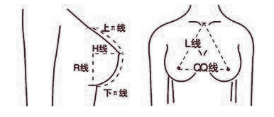 隆胸有哪些方式你都清楚吗？