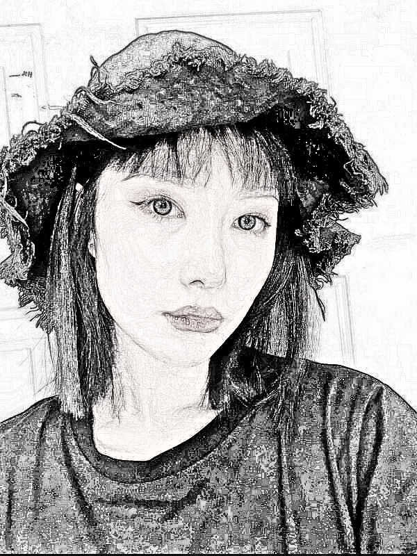 武汉希思特医疗美容医生杨权明隆鼻介绍分享！