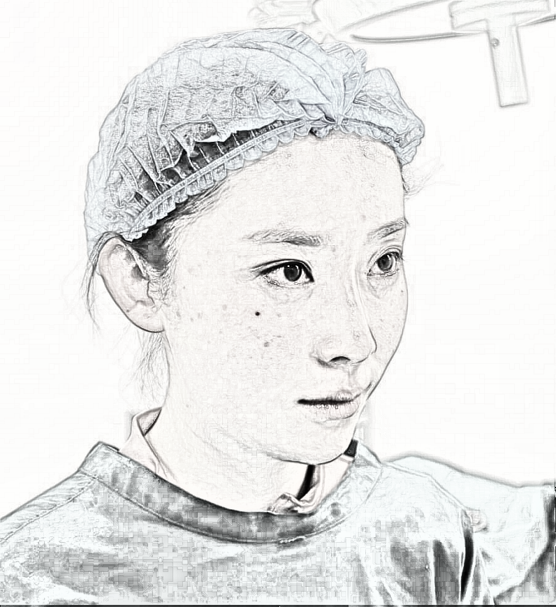 美诗沁世茂医疗美容医生韩雪激光去眼袋介绍分享!