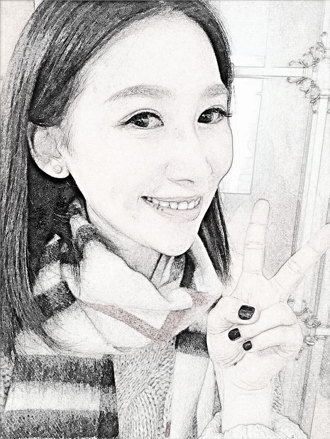 上海愉悦美联臣医疗美容医院下颚角整形介绍分享!