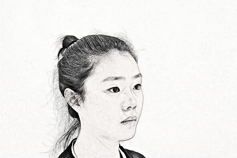北京领医医疗美容医院埋线双眼皮怎么样?