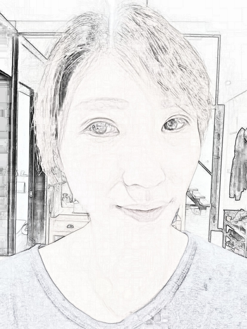 【去黑眼袋】上海美诗沁医疗美容医生刘振宇眶隔脂肪释放介绍分享!