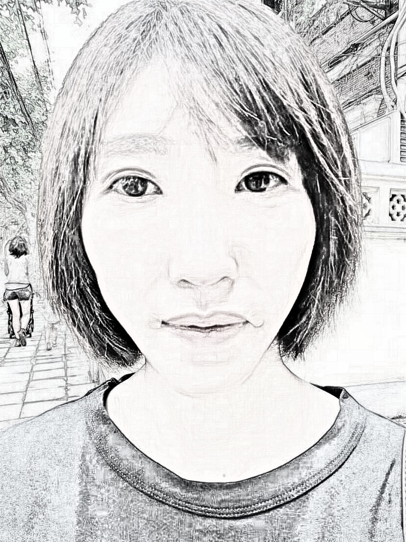 【去黑眼袋】上海美诗沁医疗美容医生刘振宇眶隔脂肪释放介绍分享!
