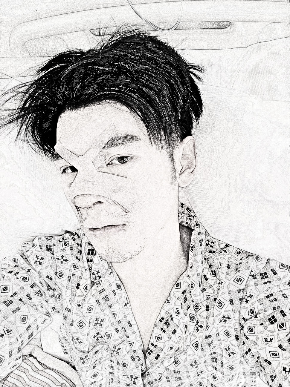 北京美莱医疗美容软肋骨隆鼻果怎么样?