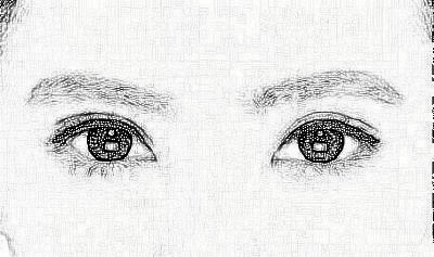 双眼皮常见的三种手术方式