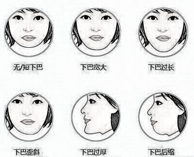 下巴整形适用那些人