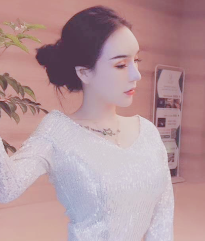 成都仪美美仁医疗美容鼻修复300天术后分享!
