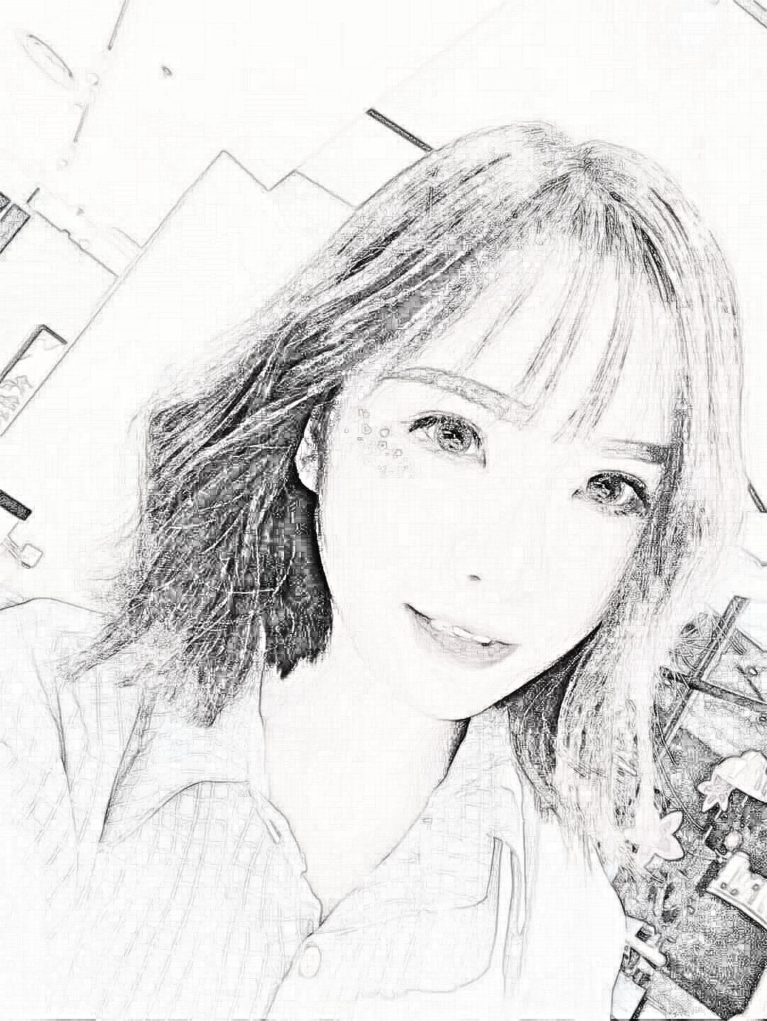 深圳南雅医疗美容医生张颖杰面部吸脂介绍分享!