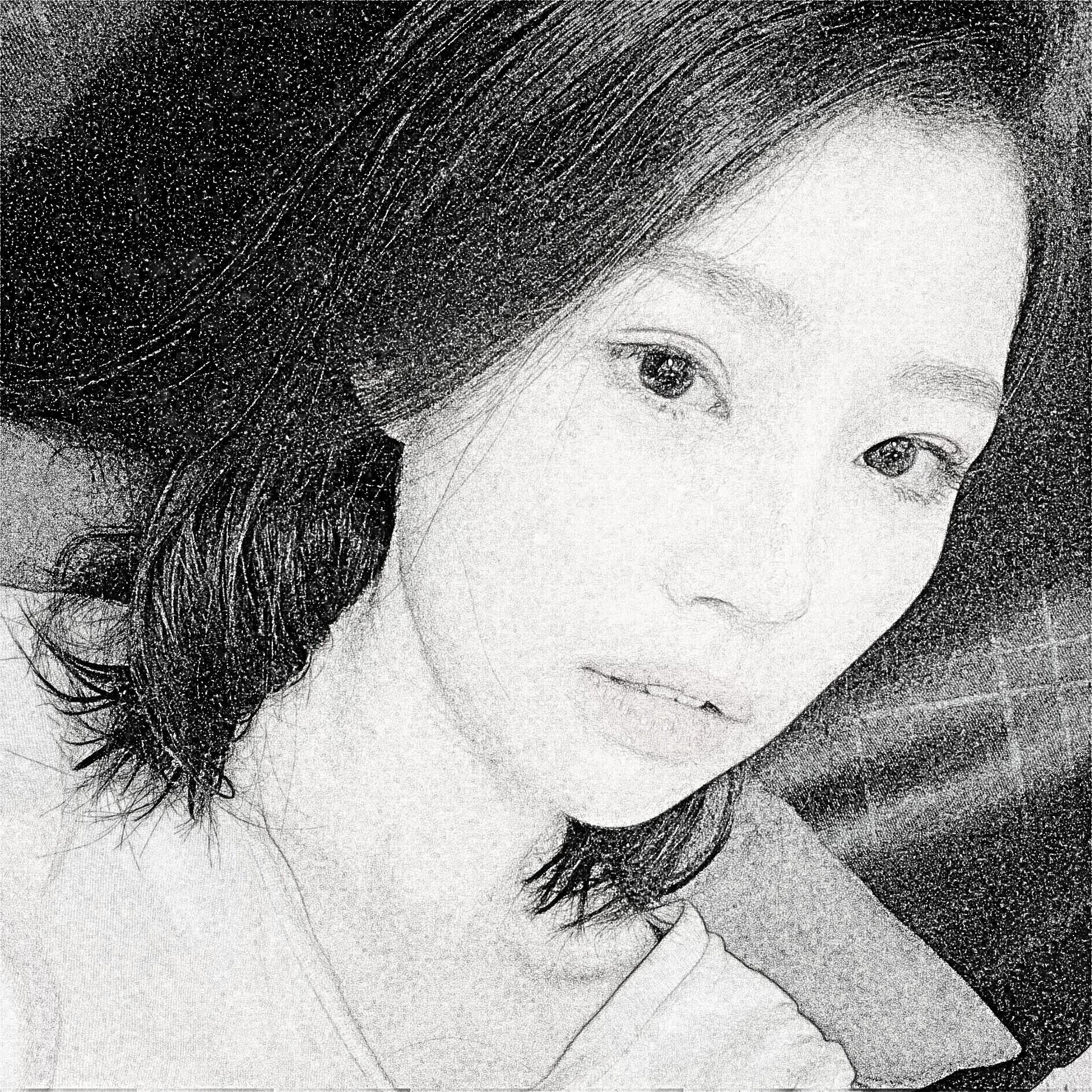 南京美贝尔整形医院面部吸脂果怎么样?