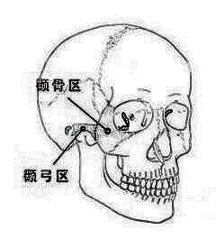 颧骨是什么样子的?