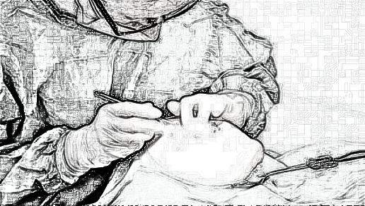 北京圣慈医疗美容医院肋软骨隆鼻果怎么样？