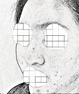 北京圣慈医疗美容医院肋软骨隆鼻果怎么样？