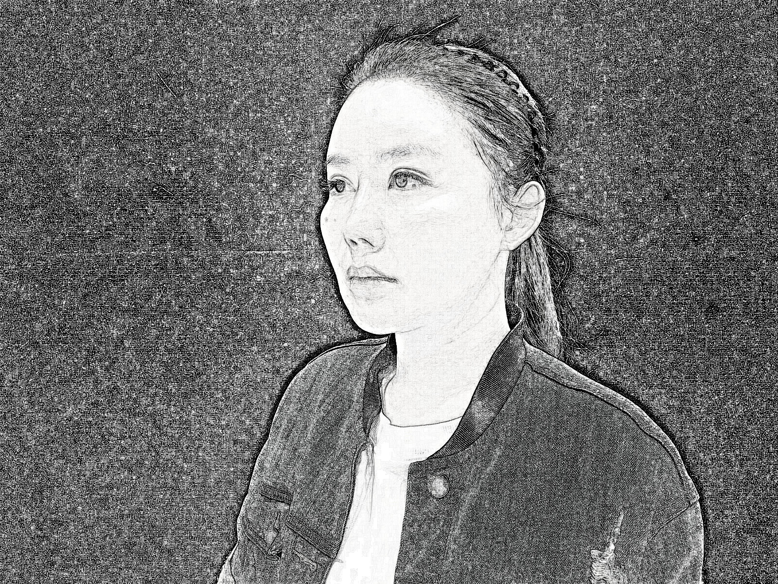 重庆郑荃丽格医美面部脂肪填充修复介绍分享!
