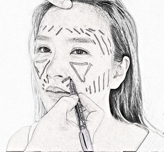 武汉自体脂肪面部填充介绍