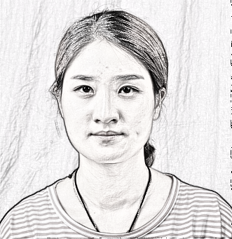 上海下颌角整形介绍,长曲线截骨