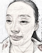 北京自体脂肪面部填充介绍分享