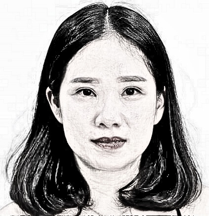 苏州双眼皮+开内眼角介绍分享