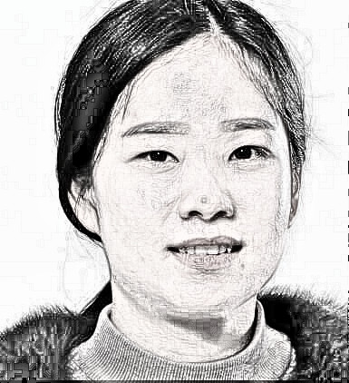 苏州双眼皮+开内眼角介绍分享