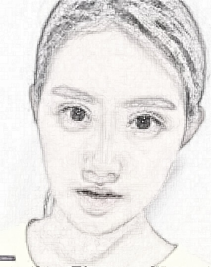 杭州自体脂肪面部填充介绍
