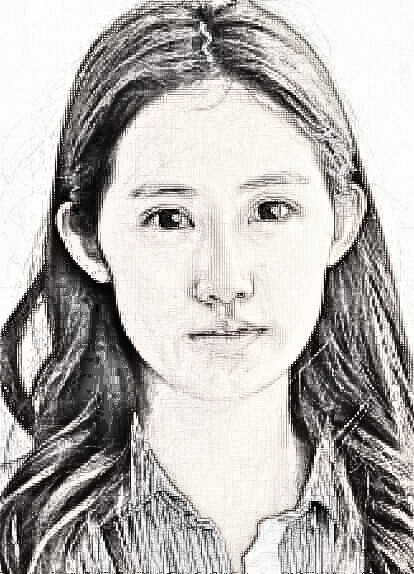 杭州自体脂肪面部填充介绍