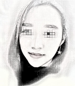 做了全脸脂肪填充,很值得的果