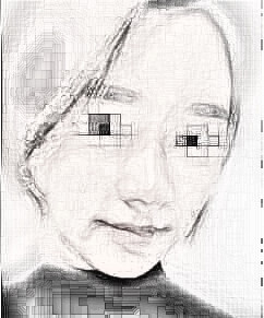 做了全脸脂肪填充,很值得的果