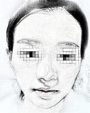 做了全脸脂肪填充,很值得的果