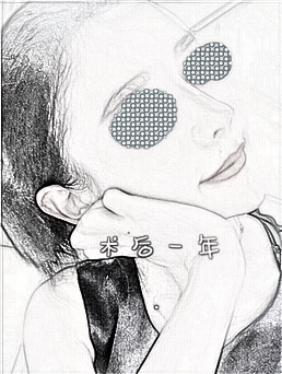 肋软骨隆鼻部手术修复手术,一年了终于变好看