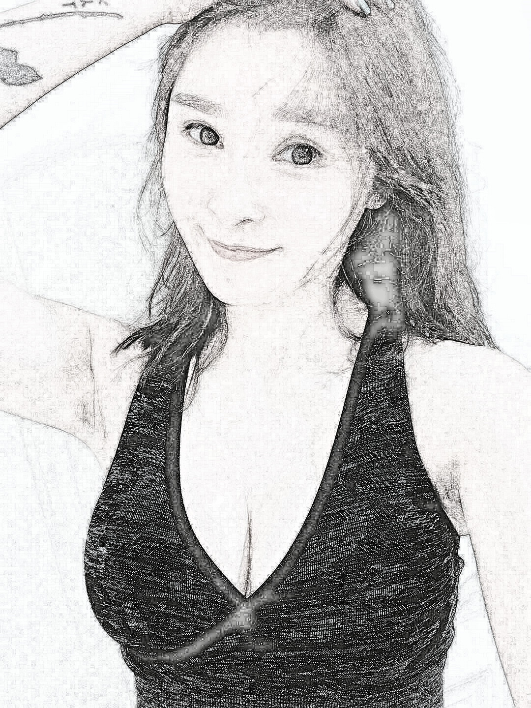 郑州美莱医疗美容医院假体隆胸介绍