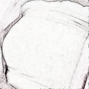 深圳假体隆胸,让她女人味十足