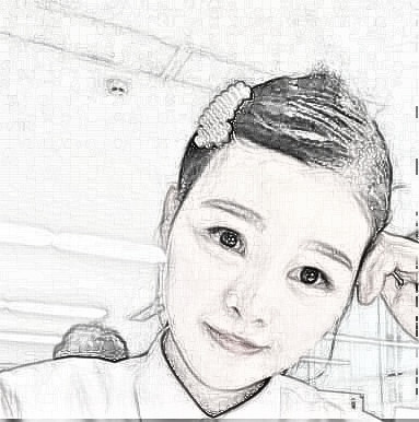 北京新生植发医院头顶加密植发8个月,还前后照哦！