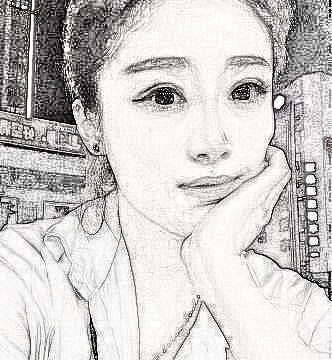 在深圳北大医院整形美容科做了隆鼻，术后经验分享