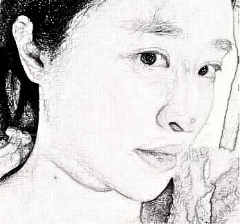 深圳非凡整形医院磨骨怎么样?术后3个月恢复成小V脸