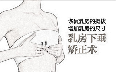 兰州黛美尔和嘉琳胸部整形哪家好 乳房下垂矫正怎么样