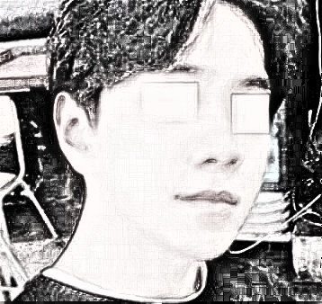 广州市第一人民医院整形外科改脸型术后流出，一览