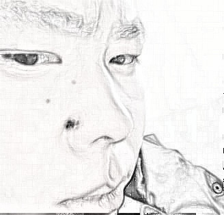 北京301陶然技术怎么样？切痣恢复分享