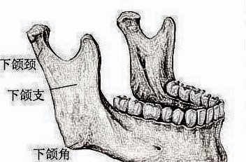 上海整形医生建议我做下颌角手术，有必要吗？