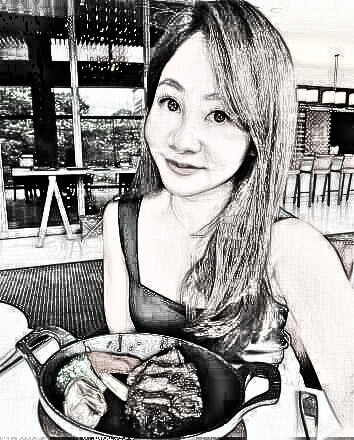 找任思雨医生做的玻尿酸填充法令纹，很自然~
